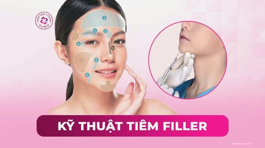 Các kỹ thuật tiêm filler môi hiện đại và quy trình chuẩn y khoa