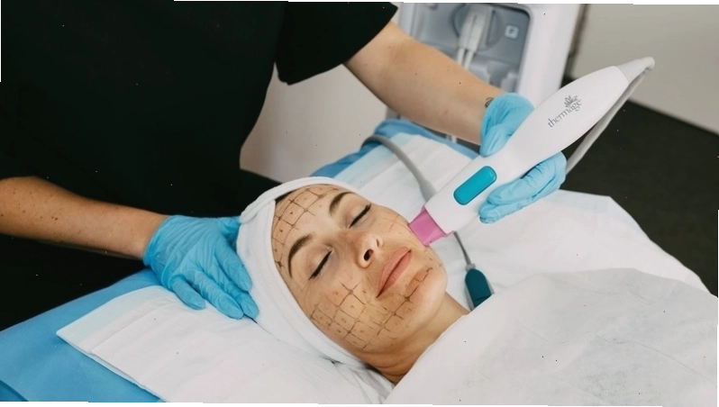 Cơ chế hoạt động của máy Thermage FLX trong việc trẻ hóa da
