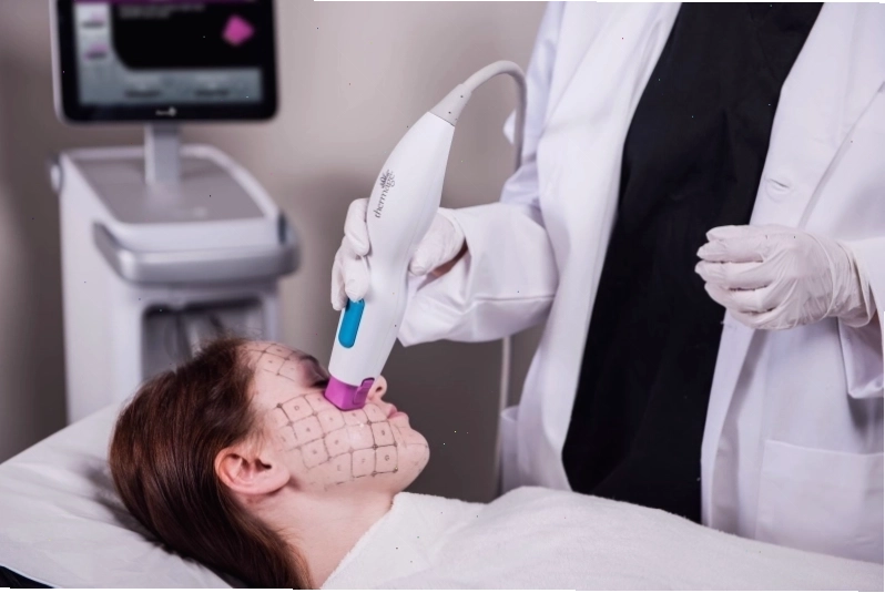 Hiệu quả trẻ hóa da sau khi sử dụng máy Thermage FLX