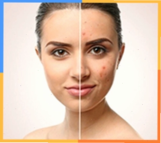 Sản phẩm chăm sóc tóc chuyên dụng