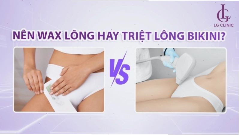 So sánh wax lông và triệt lông vùng kín