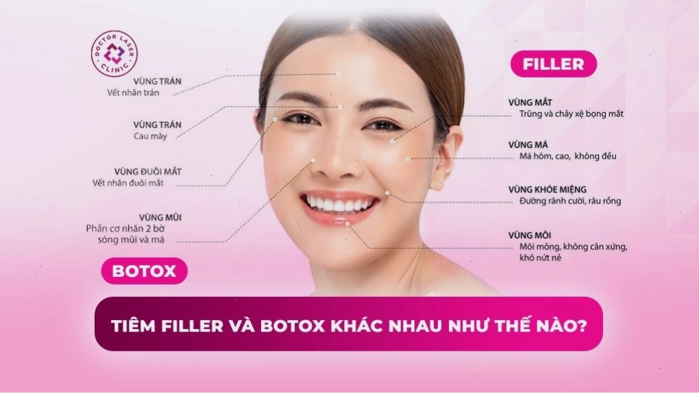 Sự khác biệt giữa tiêm filler và botox