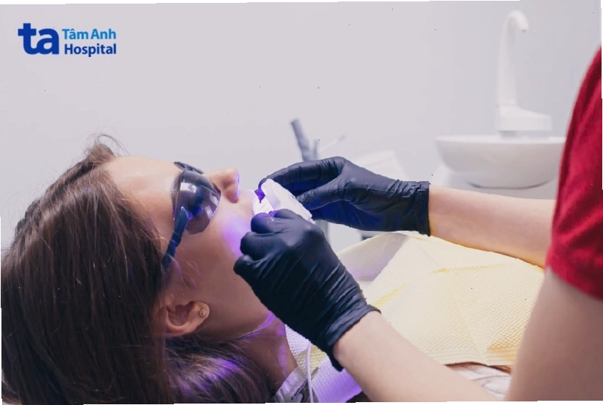 Tẩy trắng răng bằng ánh sáng đèn Laser