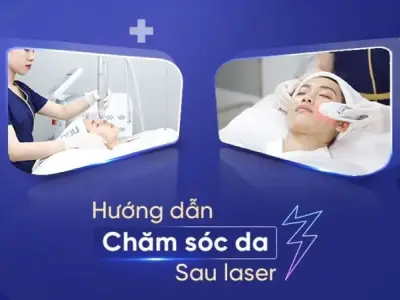 Cách chăm sóc da sau Laser giúp da phục hồi nhanh chóng