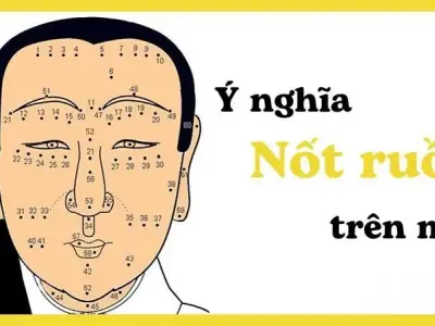 Giải mã ý nghĩa nốt ruồi trên mặt ở từng vị trí khác nhau