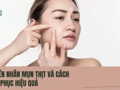 Nguyên nhân, biểu hiện và cách trị mụn thịt hiệu quả
