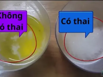 Cách nhận biết có thai bằng nước tiểu bạn cần biết