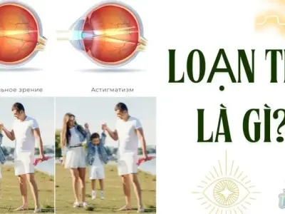 Cách nhận biết loạn thị tại nhà bạn cần biết