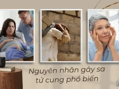 Bác sĩ hướng dẫn cách kiểm tra sa tử cung bằng tay tại nhà