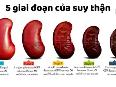 Cách nhận biết suy thận sớm để kịp thời điều trị - Suy thận có đau không?