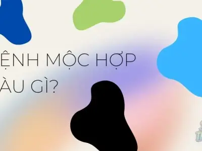 Hé lộ màu sắc hợp mệnh Mộc giúp gia chủ gặt hái thành công