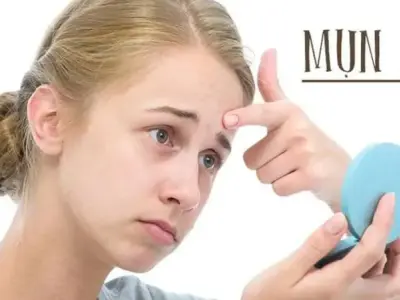 12 cách trị mụn ẩn dưới da hiệu quả được bác sĩ da liễu tin dùng