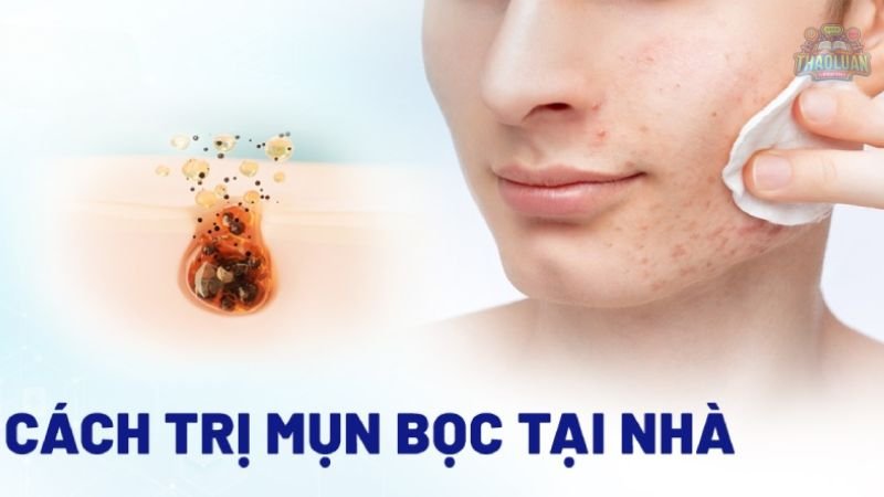 Những lưu ý khi trị mụn bọc 9