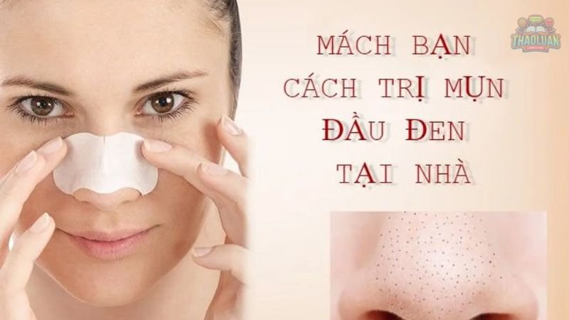 Những lưu ý khi trị mụn đầu đen tại nhà 8