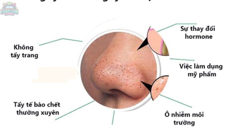 7. Sử dụng các sản phẩm trị mụn đầu đen 6