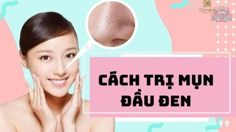 Nguyên nhân gây ra mụn đầu đen  2