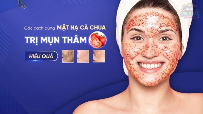 Lưu ý khi trị mụn thâm tại nhà  10