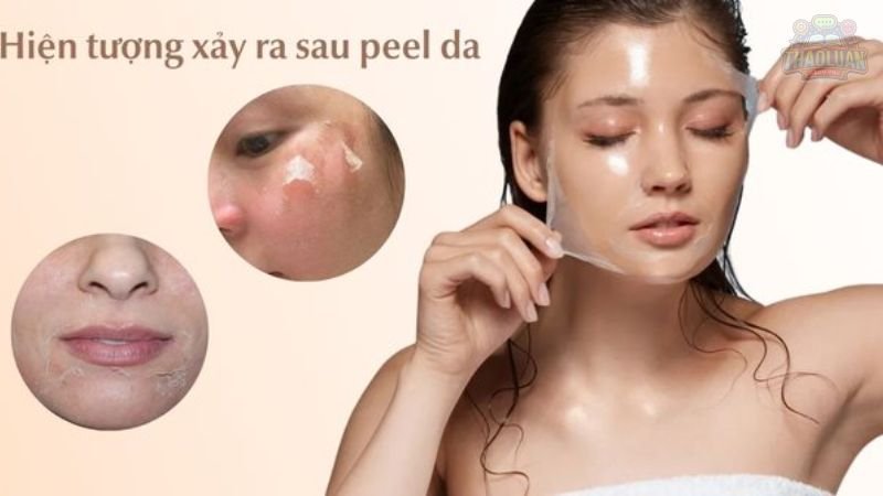 Quy trình chăm sóc da cơ bản sau peel 2