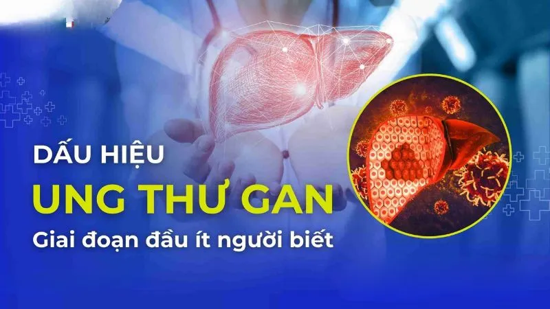 Các bệnh ung thư thường gặp